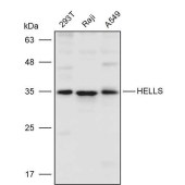 Solarbio K111423P Anti-HELLS Polyclonal Antibody