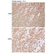Solarbio K111939P Anti-BOLL Polyclonal Antibody
