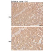 Solarbio K111291P Anti-BCAR3 Polyclonal Antibody