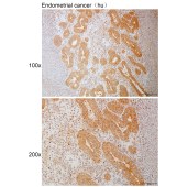 Solarbio K111116P Anti-RNF19A Polyclonal Antibody