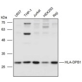 Solarbio K111429P Anti-HLA-DPB1 Polyclonal Antibody