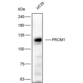 Solarbio K111894P Anti-PROM1 Polyclonal Antibody