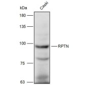 Solarbio K111287P Anti-RPTN Polyclonal Antibody