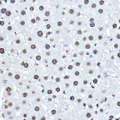 Solarbio K009993P Anti-Twist Polyclonal Antibody