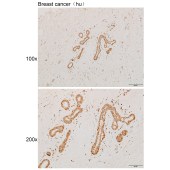 Solarbio K111881P Anti-NCAPH Polyclonal Antibody