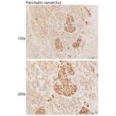 Solarbio K111285P Anti-IL4R Polyclonal Antibody
