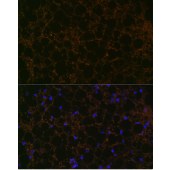 Solarbio K009922M Anti-Perilipin A Monoclonal Antibody