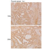 Solarbio K110920P Anti-GLB1L2 Polyclonal Antibody