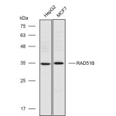 Solarbio K110817P Anti-RAD51B Polyclonal Antibody