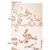 Solarbio K112138P Anti-RLN2 Polyclonal Antibody