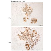 Solarbio K112140P Anti-ZNF25 Polyclonal Antibody