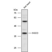Solarbio K111434P Anti-SGCD Polyclonal Antibody