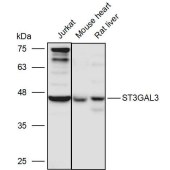 Solarbio K111230P Anti-ST3GAL3 Polyclonal Antibody