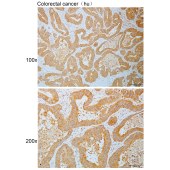 Solarbio K110825P Anti-GUCY1A1 Polyclonal Antibody