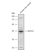 Solarbio K111608P Anti-INTS12 Polyclonal Antibody