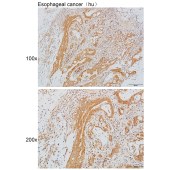 Solarbio K111632P Anti-SLC4A1AP Polyclonal Antibody