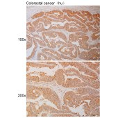 Solarbio K111022P Anti-LOC440248 Polyclonal Antibody