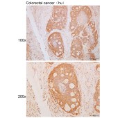 Solarbio K111664P Anti-NCEH1 Polyclonal Antibody