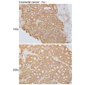 Solarbio K111636P Anti-GPR158 Polyclonal Antibody