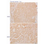 Solarbio K110544P Anti-CATSPER1 Polyclonal Antibody