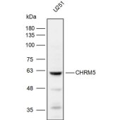 Solarbio K111976P Anti-CHRM5 Polyclonal Antibody