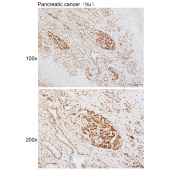 Solarbio K111643P Anti-MKI67 Polyclonal Antibody