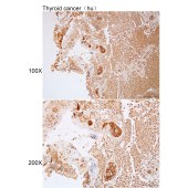 Solarbio K112135P Anti-DYNLT5 Polyclonal Antibody