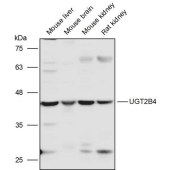 Solarbio K111425P Anti-UGT2B4 Polyclonal Antibody