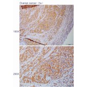 Solarbio K110902P Anti-HMMR Polyclonal Antibody