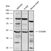 Solarbio K111063P Anti-COQ8A Polyclonal Antibody