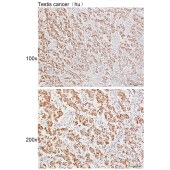 Solarbio K111637P Anti-PLCB3 Polyclonal Antibody