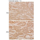Solarbio K111984P Anti-GSTM5 Polyclonal Antibody