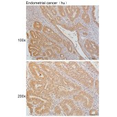 Solarbio K111644P Anti-DDX39A/B Polyclonal Antibody