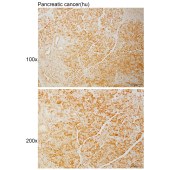Solarbio K111038P Anti-SMARCAL1 Polyclonal Antibody