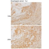 Solarbio K111889P Anti-DSG1 Polyclonal Antibody