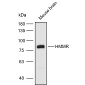 Solarbio K110901P Anti-HMMR Polyclonal Antibody