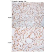 Solarbio K110817P Anti-RAD51B Polyclonal Antibody