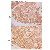 Solarbio K111685P Anti-MRPL46 Polyclonal Antibody
