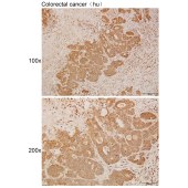 Solarbio K111954P Anti-EXOSC7 Polyclonal Antibody