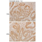 Solarbio K111236P Anti-ULK3 Polyclonal Antibody