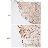 Solarbio K112120P Anti-TEKT2 Polyclonal Antibody