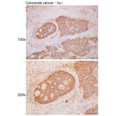 Solarbio K111652P Anti-GPA33 Polyclonal Antibody