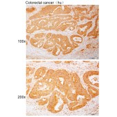 Solarbio K110571P Anti-SECISBP2L Polyclonal Antibody