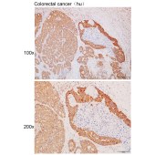 Solarbio K111692P Anti-LY6D Polyclonal Antibody