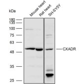 Solarbio K111905P Anti-CXADR Polyclonal Antibody