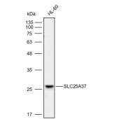 Solarbio K112114P Anti-SLC25A37 Polyclonal Antibody