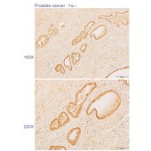 Solarbio K110586P Anti-PHF13 Polyclonal Antibody