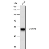 Solarbio K111667P Anti-UGT1A9 Polyclonal Antibody
