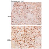 Solarbio K111702P Anti-KLHL10 Polyclonal Antibody