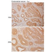 Solarbio K110995P Anti-WSCD2 Polyclonal Antibody